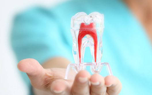 Dra. Grisoski - Endodoncia