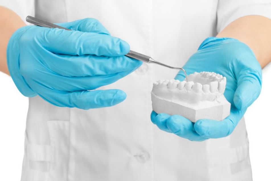 Dra. Grisoski - Coronas Sobre Implantes